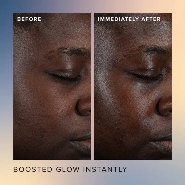 Honey Glow 17% AHA + BHA Resurfacing Acid Serum - Image 4