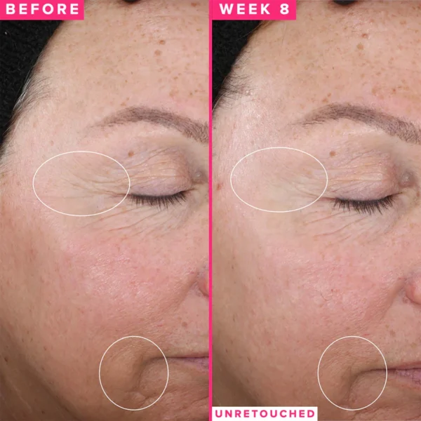 1% Vitamin A Retinol Serum Firms + Targets Fine Lines + Deep Wrinkles - Image 5